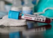 MUI Keluarkan Fatwa: Pasien Positif Corona Haram Salat di Masjid