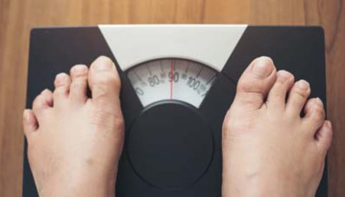 Ingat! Kurang Aktivitas Fisik Sebabkan Obesitas