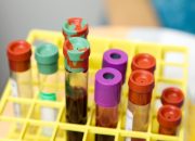Kemenkes Fasilitasi Investasi SK Plasma, INA Untuk Produksi Plasma