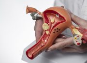 Tanggulangi Kematian Perempuan dengan Skrining Kanker Serviks