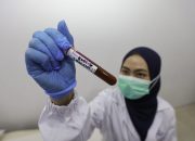 Pemerintah Percepat Produksi Bahan Baku Obat Dalam Negeri