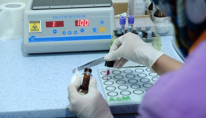 Pemerintah Alokasikan APBN Rp3,4 Triliun untuk Program Cek Kesehatan Gratis