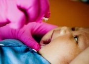 Pemerintah Umumkan Kejadian Luar Biasa Polio Berakhir